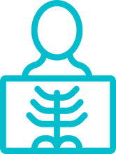 Radiografie (RX)