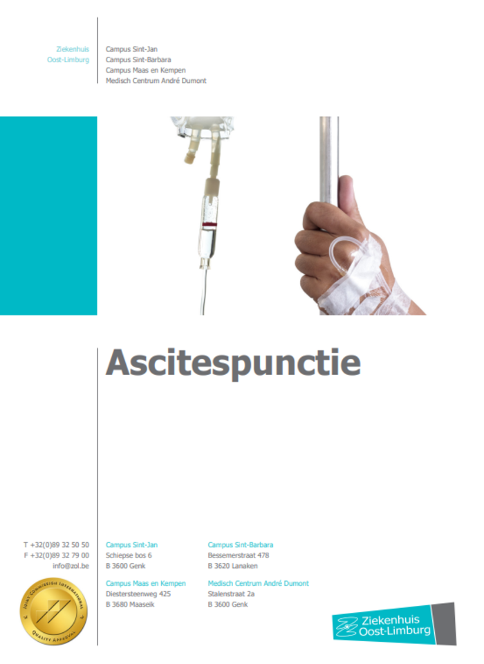 Ascitespunctie