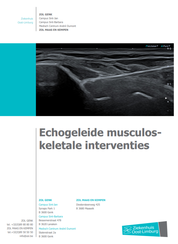 Echogeleide muscoloskeletale interventies